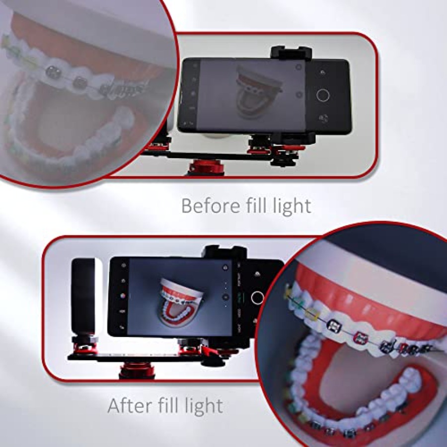 Bluetooth Dental Flash Light P - Photography Lighting Flash ulasan dan harga